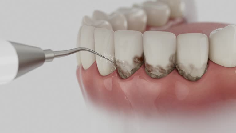Reliable Dental Implants contractor in Kasson, MN by Smile Center Dentistry